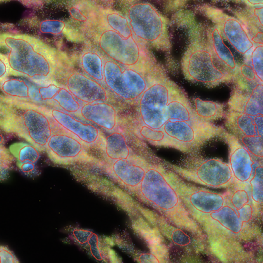 Spatial Transcriptomics